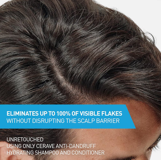 CeraVe Hydrating Anti Dandruff Sjampoe en Opknapper Stel, Pyrithione Zinc Behandeling met Ceramides, Hialuroonsuur & Niasinamied