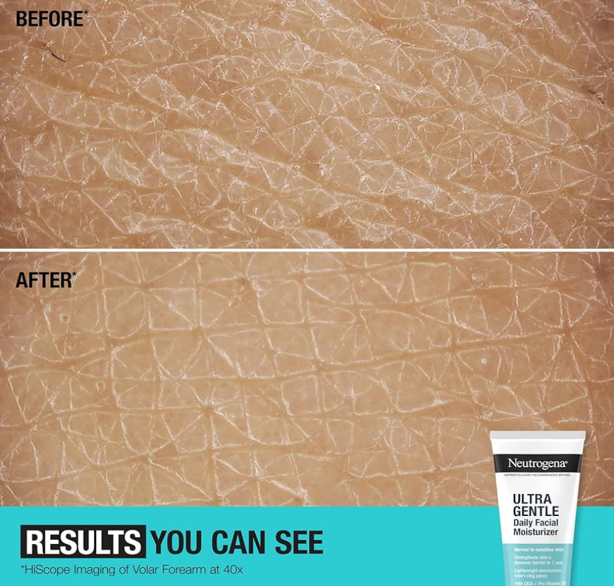 Neutrogena Geurvrye Daaglikse Gesigbevogtiger vir Sensitiewe Vel met Vitamien B3, Pro-Vitamien B5 & Vitamien E - (100 ml)