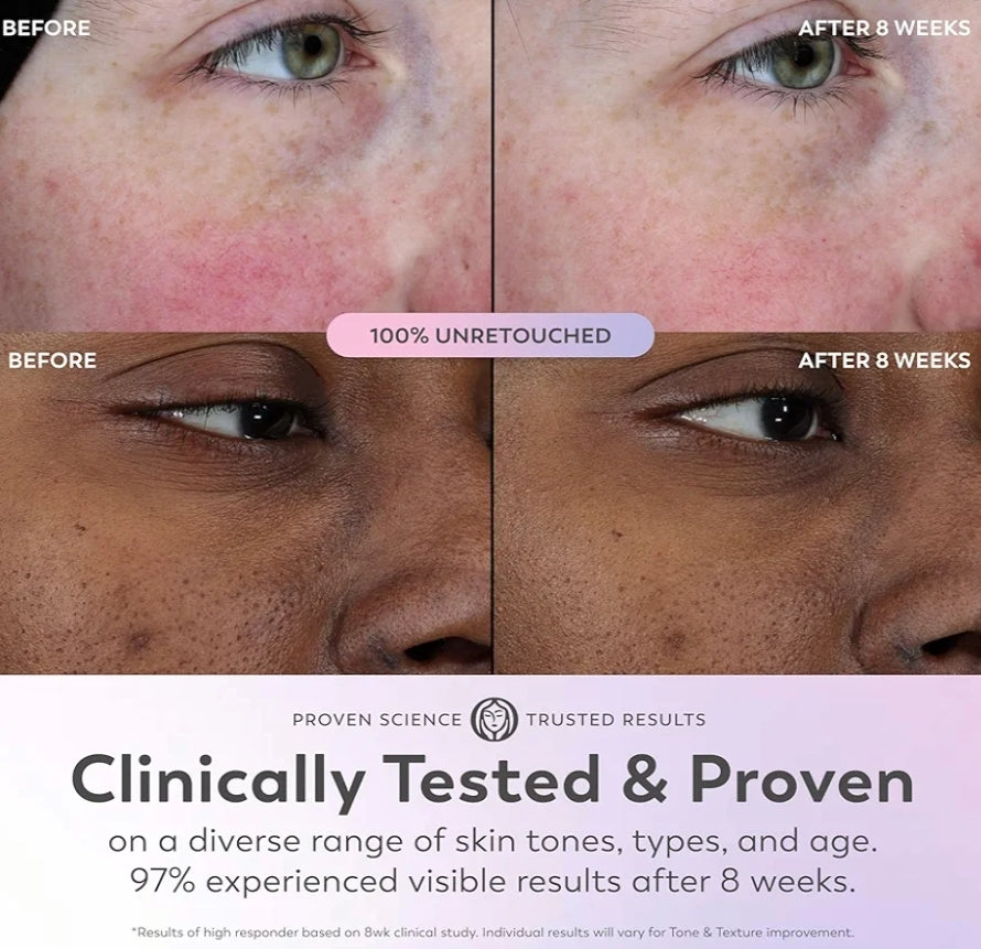 Olay Super Serum - Niasienamied, Vitamien C & E, Kollageenpeptied, AHA - 5-in-1 Velversorging Verhelderend Anti-Veroudering (29 ml)