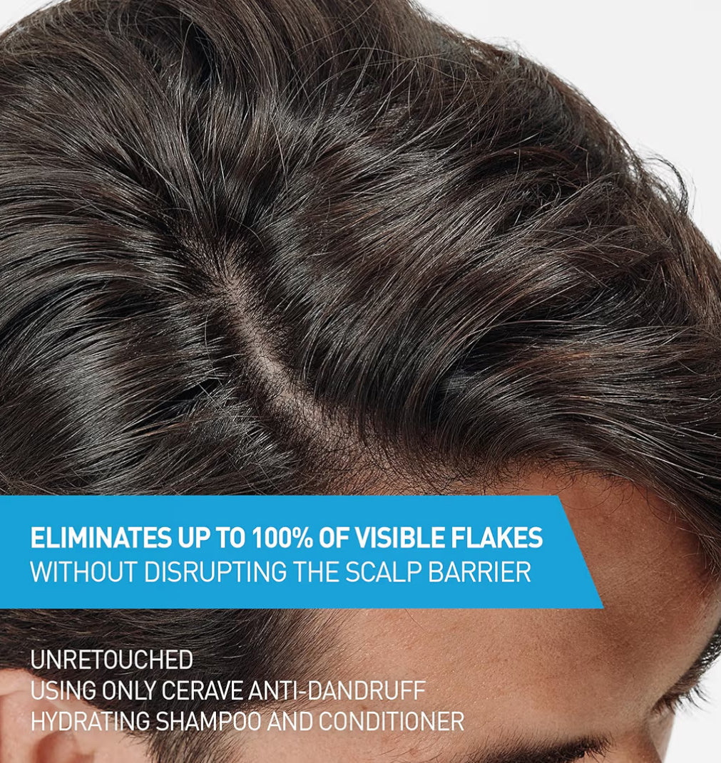 CeraVe Hydraterende Anti-Roos Opknapper, 0.5% Pyrithione Sinks Roosbehandeling m/ Seramiede, Hialuroonsuur & Niasienamied