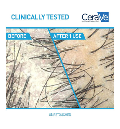 CeraVe Hydraterende Anti-Roos Opknapper, 0.5% Pyrithione Sinks Roosbehandeling m/ Seramiede, Hialuroonsuur & Niasienamied
