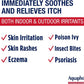 Aquaphor Itch Relief Ointment, Maximum Strength 1% Hydrocortisone Relieves Itch