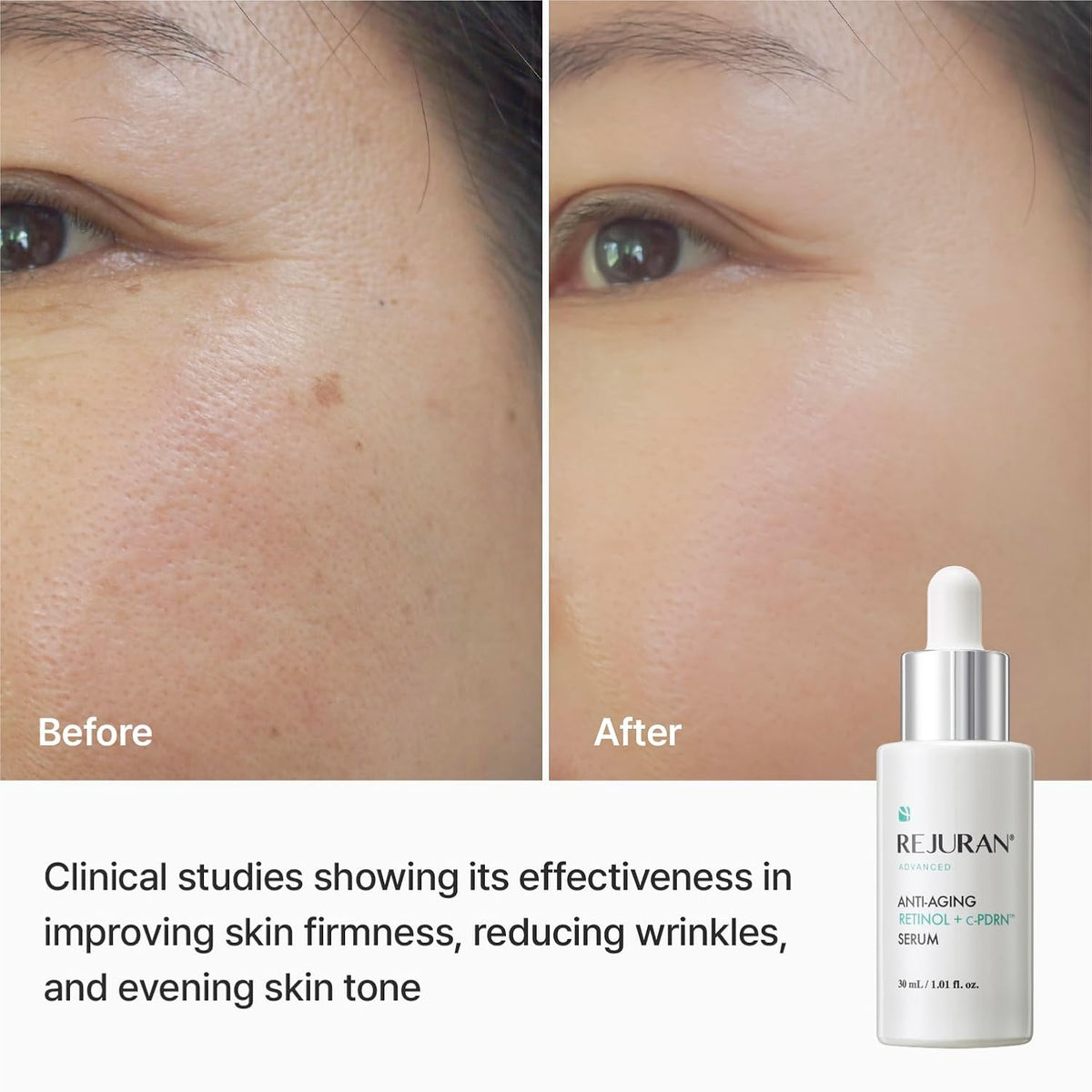 REJURAN Advanced Anti-Aging Retinol + c-PDRN® Serum, 1.01 fl oz