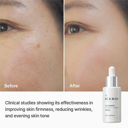 REJURAN Advanced Anti-Aging Retinol + c-PDRN® Serum, 1.01 fl oz