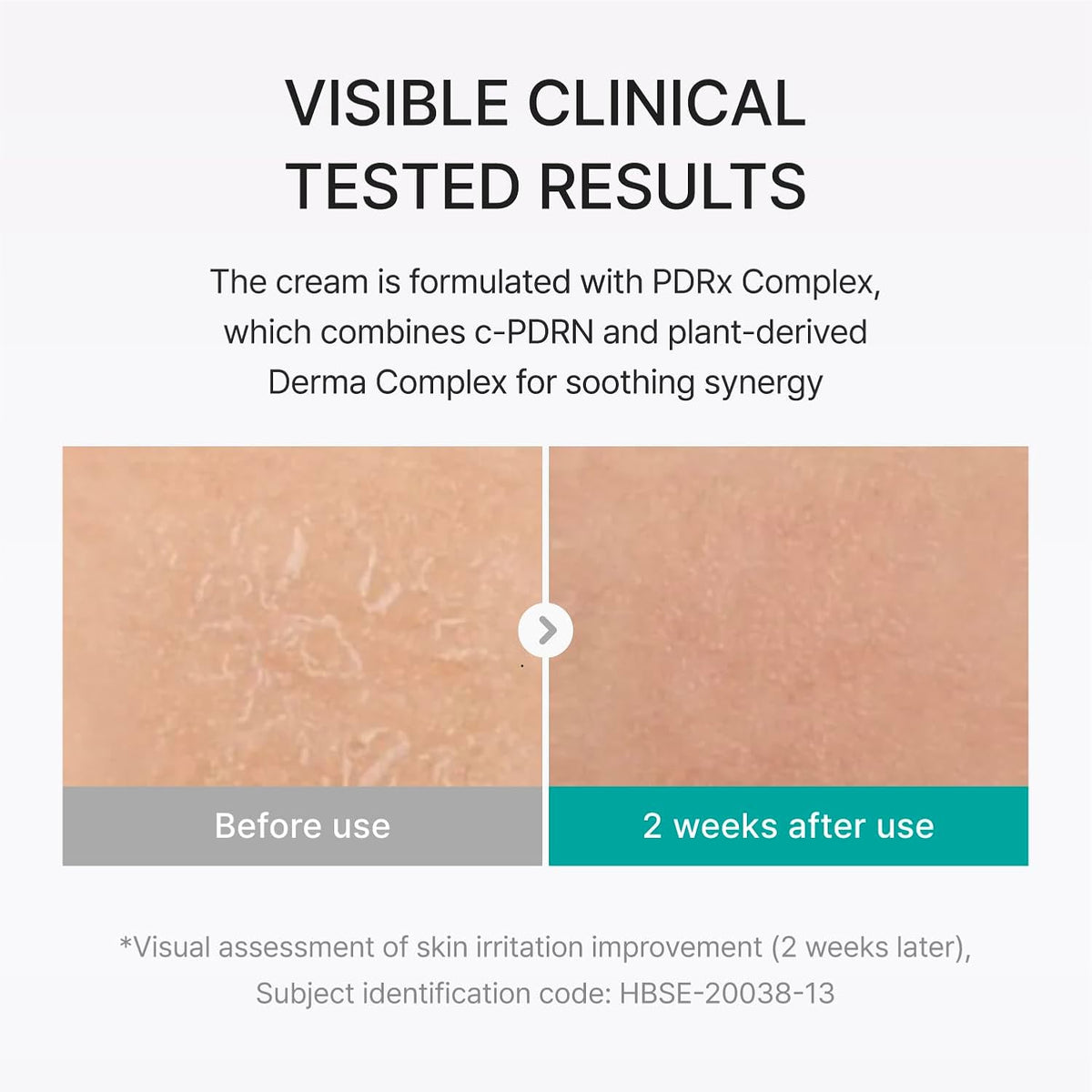 REJURAN® Moisture Cream, c-PDRN® - Daily Moisturizer for Long-Lasting Hydration and Skin Barrier Support with PDRx. (2.11 oz)