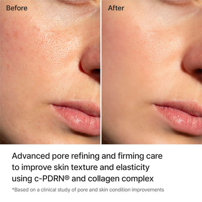REJURAN Pore Tightening Gel Mask, DOT™ c-PDRN® Hydrogel, 5 Count