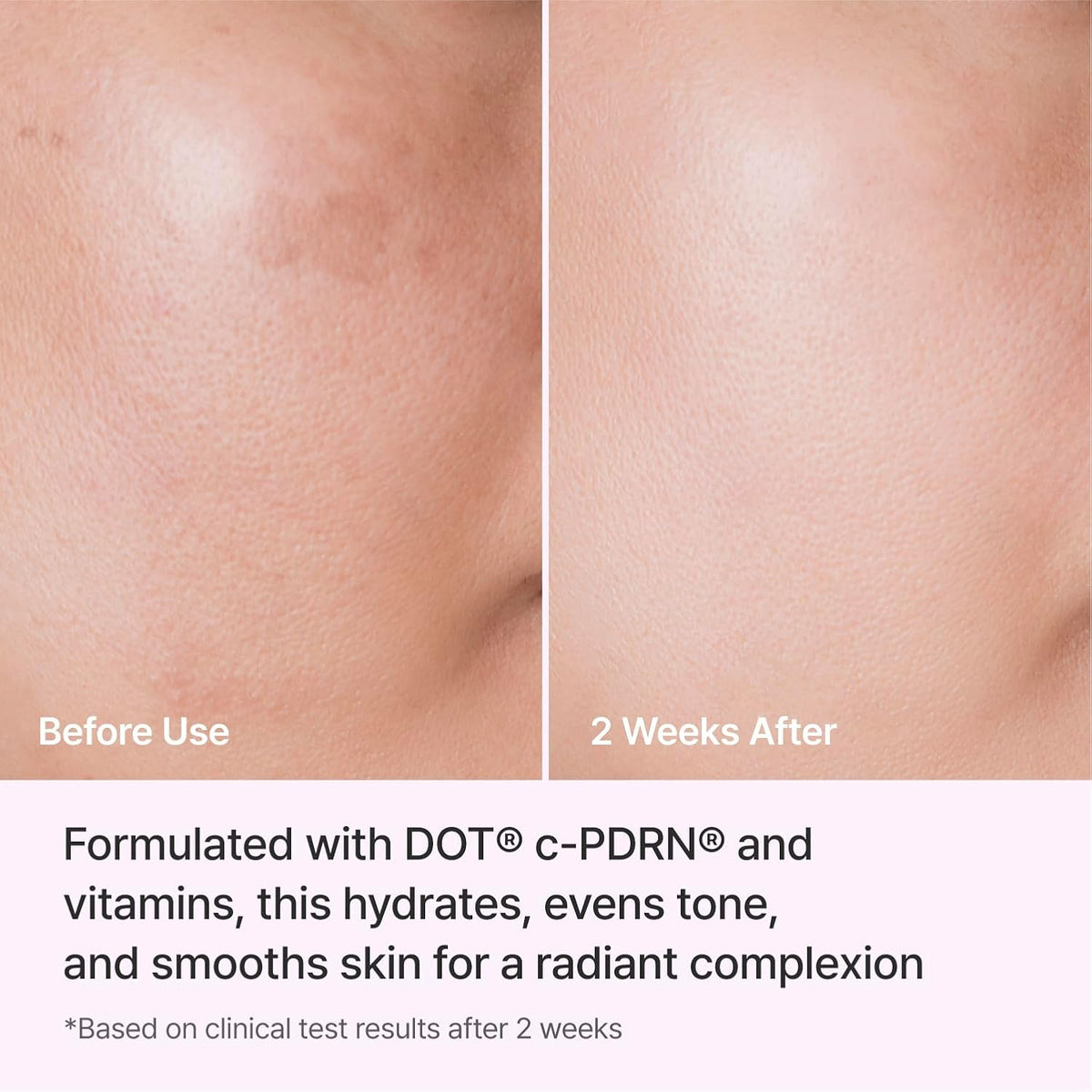 REJURAN Triple Radiance Cream, DOT™ c-PDRN® 0.2% Moisturizer, 1.69 fl oz