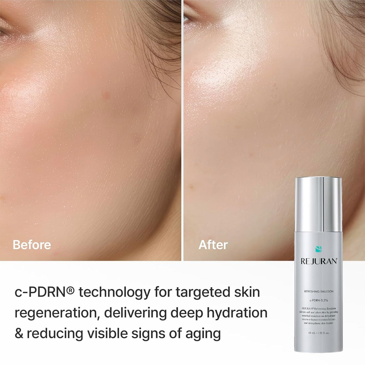 REJURAN Refreshing Emulsion, c-PDRN® Face Moisturizer, 1.52 fl oz