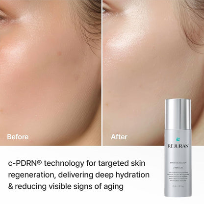 REJURAN Refreshing Emulsion, c-PDRN® Face Moisturizer, 1.52 fl oz