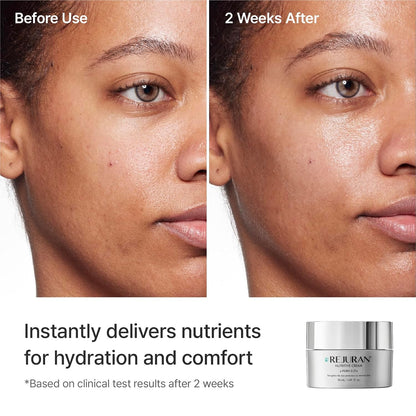 REJURAN Nutritive Cream, c-PDRN® Rich Hydrating Moisturizer 1.69 fl oz
