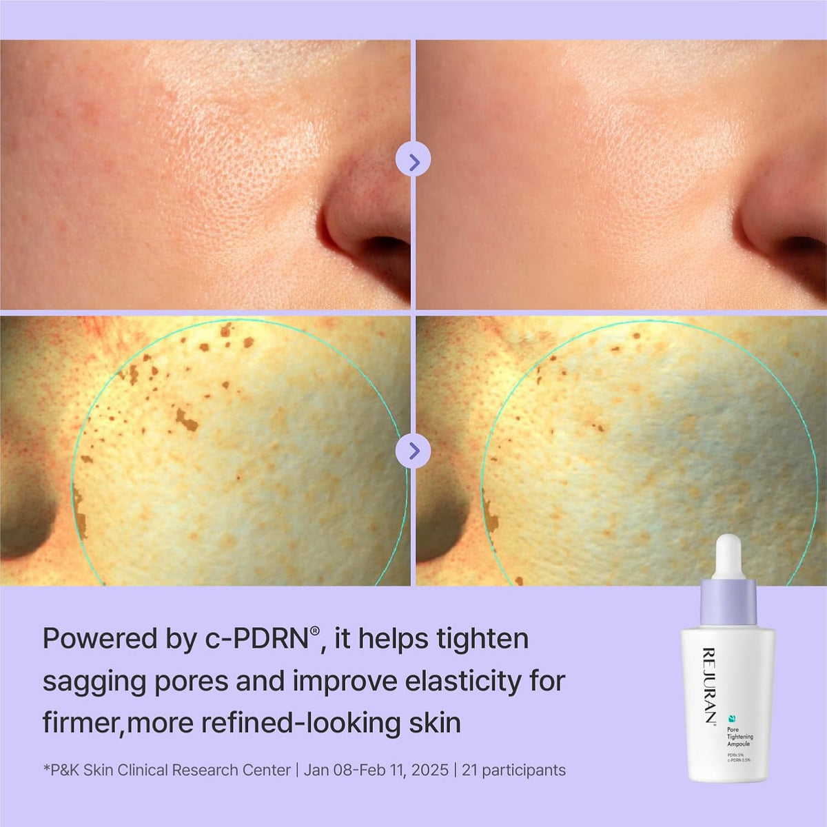 REJURAN Pore Tightening Ampoule, PDRx 5% & c-PDRN® 0.5%, 1.01 fl oz