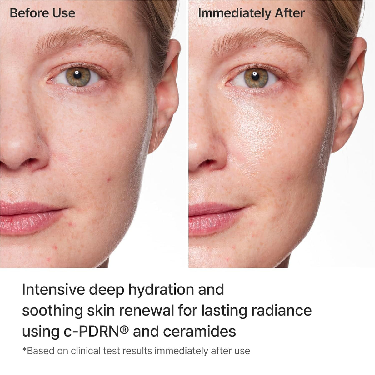 REJURAN Turnover Mask, c-PDRN® Face Mask, 5ea x 1.35 fl oz