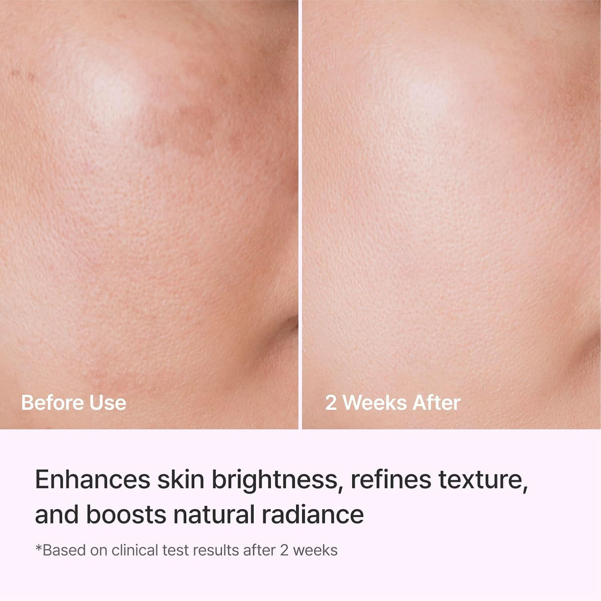 REJURAN Triple Radiance Ampoule c-PDRN® Brightening Face Serum, 1.69 fl oz