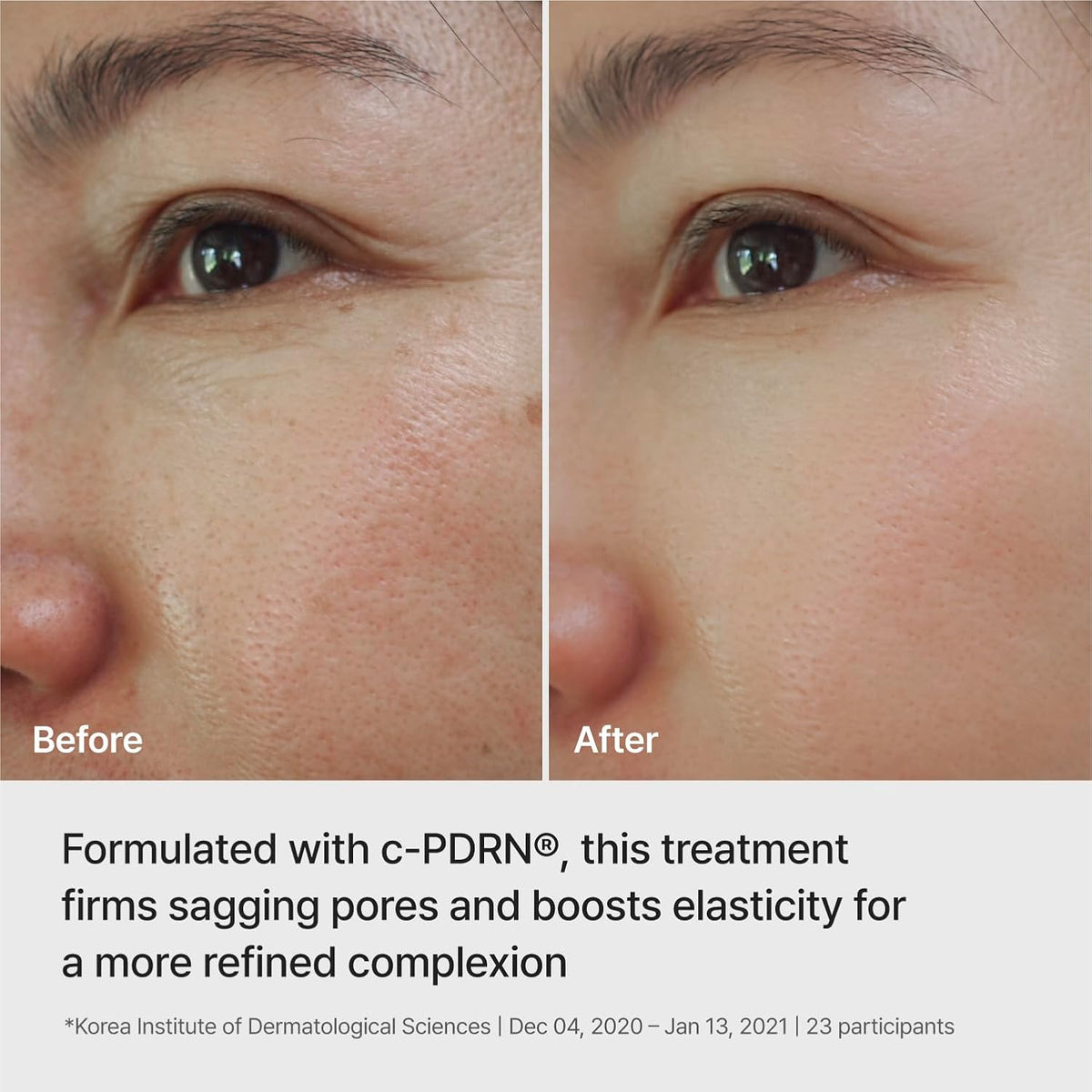 REJURAN Ampoule Infused Lifting Mask, DOT™ c-PDRN® Hydrogel, 4 Count