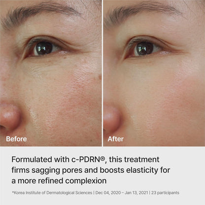 REJURAN Rebalancing Toner, c-PDRN® Hydrating & Soothing, 4.05 fl oz