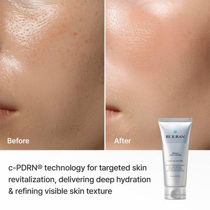 REJURAN Refining Foam Cleanser, c-PDRN® Facial Cleanser, 4.05 fl oz