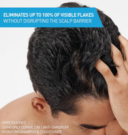 CeraVe 2 In 1 Hydraterende Anti-Roos Sjampoe En Conditioner, 1% Pirition Sinks Roosbehandeling - Kleurveilig & Sulfaatvry