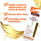 Palmer's Stretch Mark Care Body Lotion + Body Oil Bundle, Cocoa Butter Formula w/ Vitamin E Skin Care