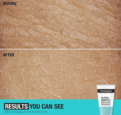Neutrogena Geurvrye Daaglikse Gesigbevogtiger vir Sensitiewe Vel met Vitamien B3, Pro-Vitamien B5 & Vitamien E - (100 ml)
