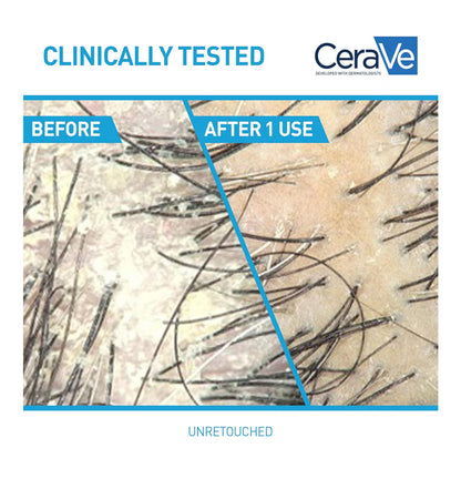 CeraVe 2 In 1 Hydraterende Anti-Roos Sjampoe En Conditioner, 1% Pirition Sinks Roosbehandeling - Kleurveilig & Sulfaatvry