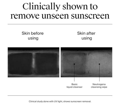Neutrogena Sagte Gesigsreinigingsdoekies Ultra-sagte Micellêre Reinigingsdoekies Geurloos Vir Sensitiewe Vel, Hipoallergeen (25 stuks)