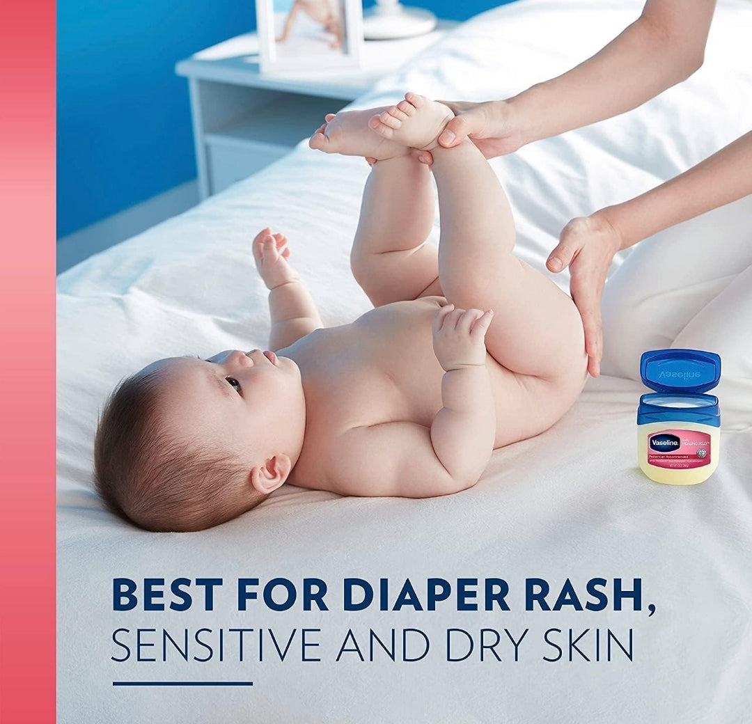 Vaseline Petroleum Jelly Baby Skincare Protective & Pure 4 Count Treats Dry Skin And Prevents Chaffed Skin From Diaper Rash Hypoallergenic And Gentle On Skin 13oz