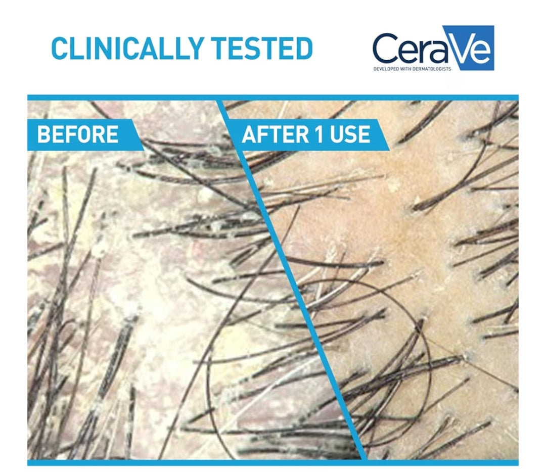 CeraVe 2 In 1 Hidrerende Anti-Roos Sjampoe En Conditioner, 1% Pirition Sinks Roosbehandeling, Kleurveilig & Sulfaatvry - Verlig Jeukerige Kopvel