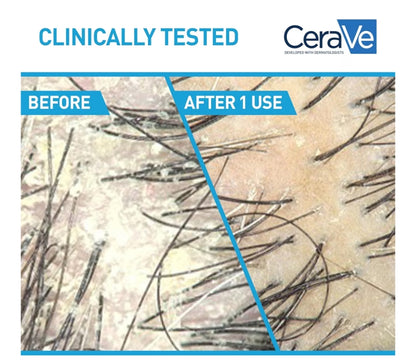 CeraVe 2 In 1 Hidrerende Anti-Roos Sjampoe En Conditioner, 1% Pirition Sinks Roosbehandeling, Kleurveilig & Sulfaatvry - Verlig Jeukerige Kopvel